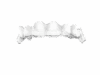 transparente-aligner-zahnschiene