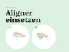 Person setzt durchsichtigen Aligner vorsichtig auf die Zähne auf.
